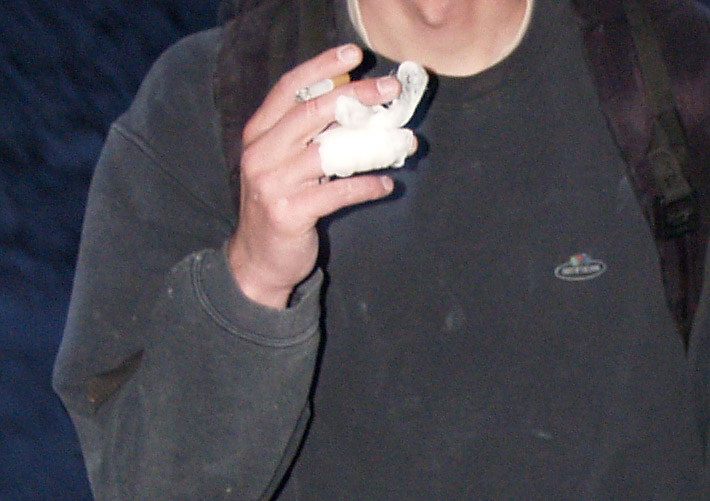 Finger cut from sharp rocks